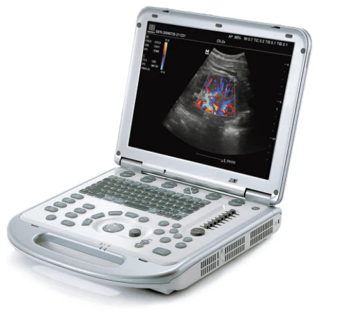 Portable Ultrasound Scanner
