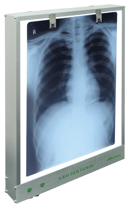 X-Ray Film Viewer