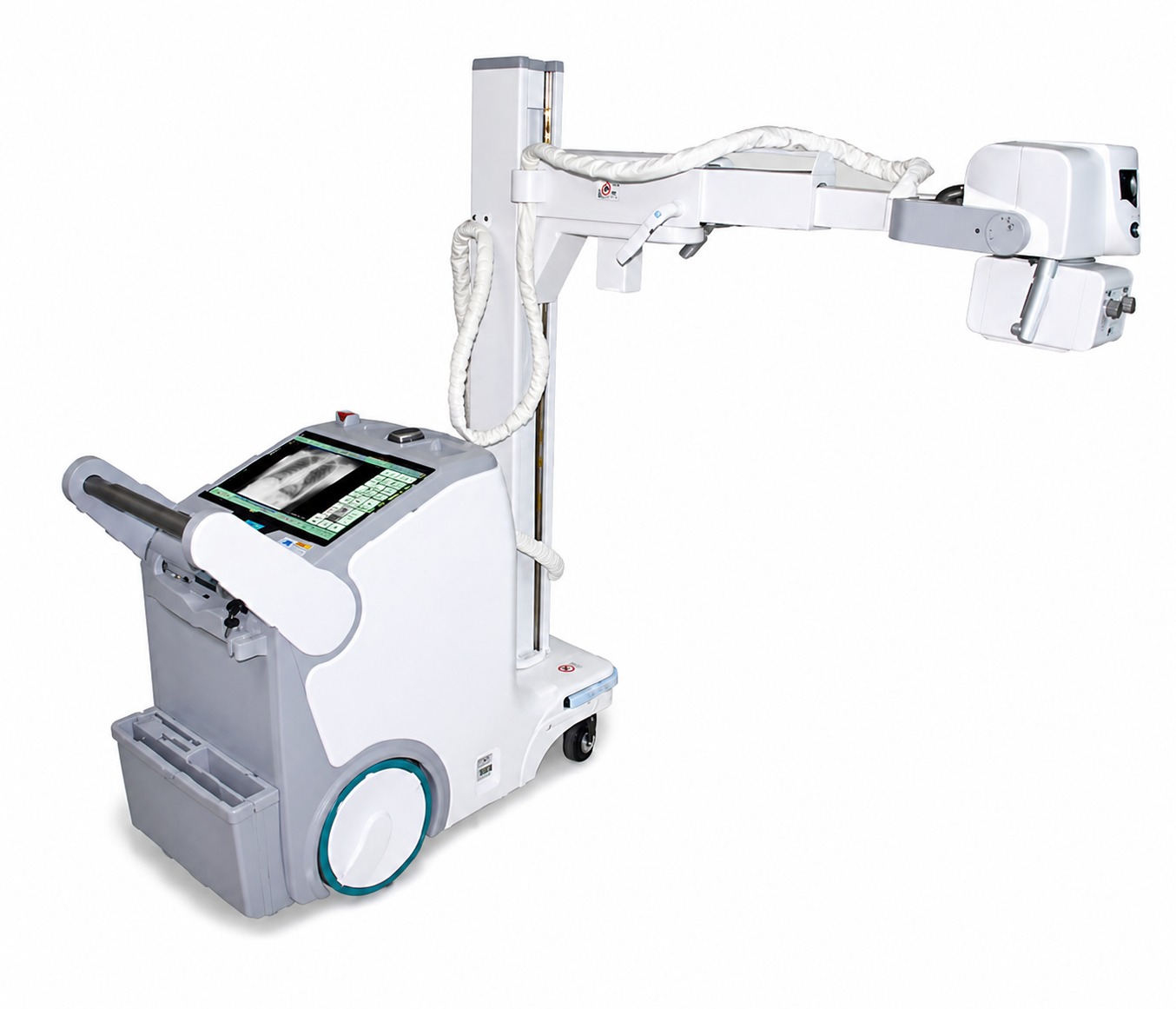 Digital Mobile X-Ray